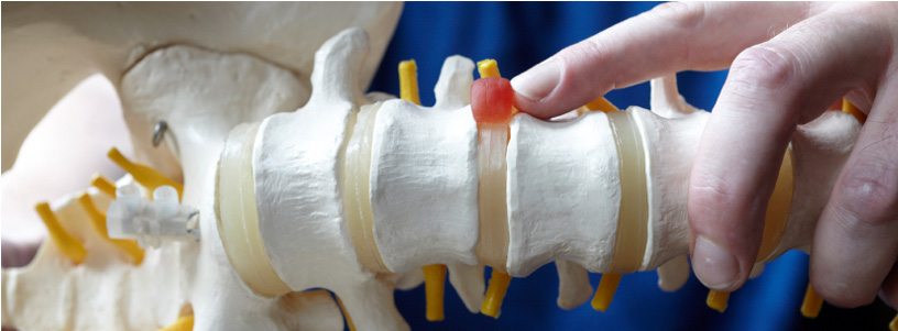 spinal cord injuries